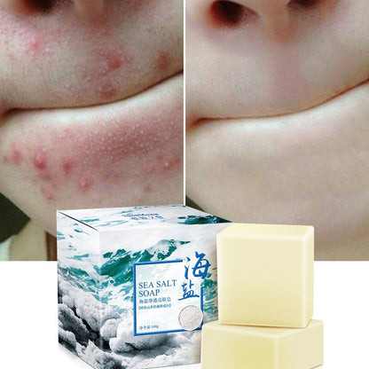 Acarus killing Skin Care Moisturizing Soap