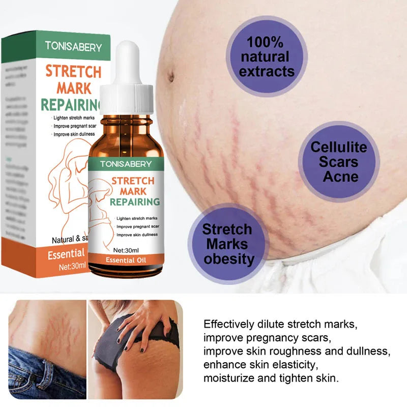 Stretch Mark Removal Oil