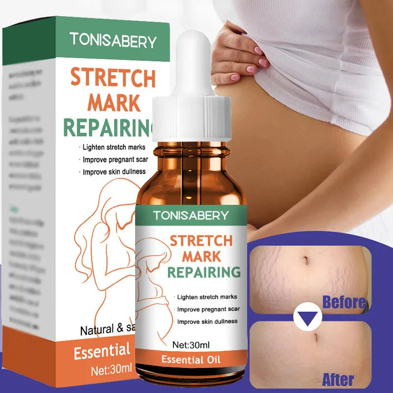 Stretch Mark Removal Oil