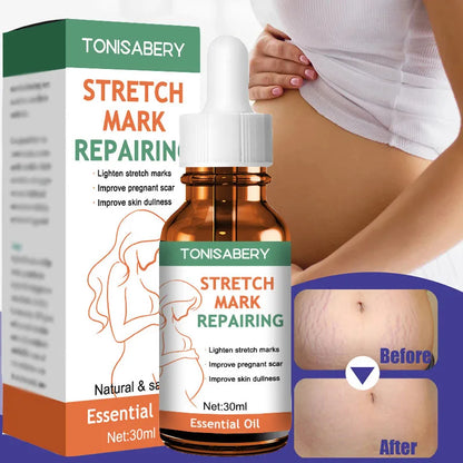 Stretch Mark Removal Oil